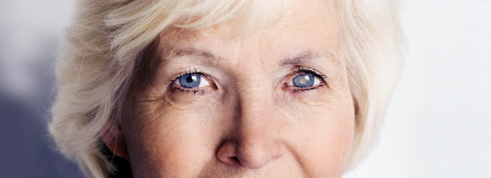 Cataract Surgery in Golden