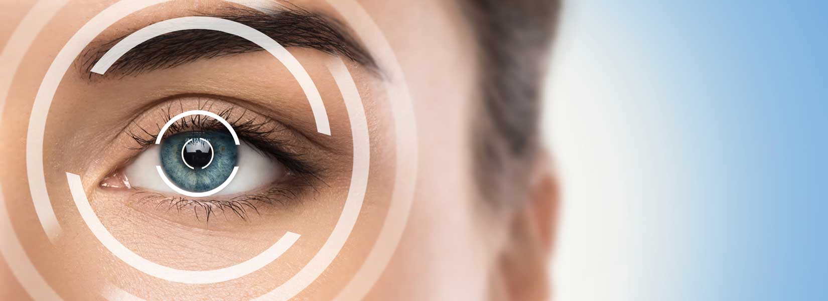 LASIK & Refractive Surgery Co-Management in Golden
